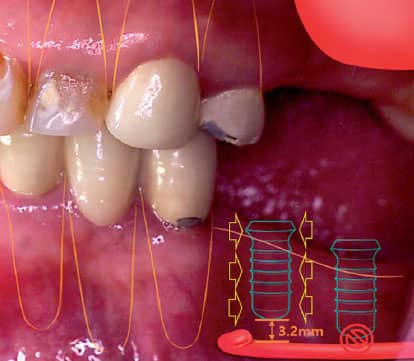 feature image jpg